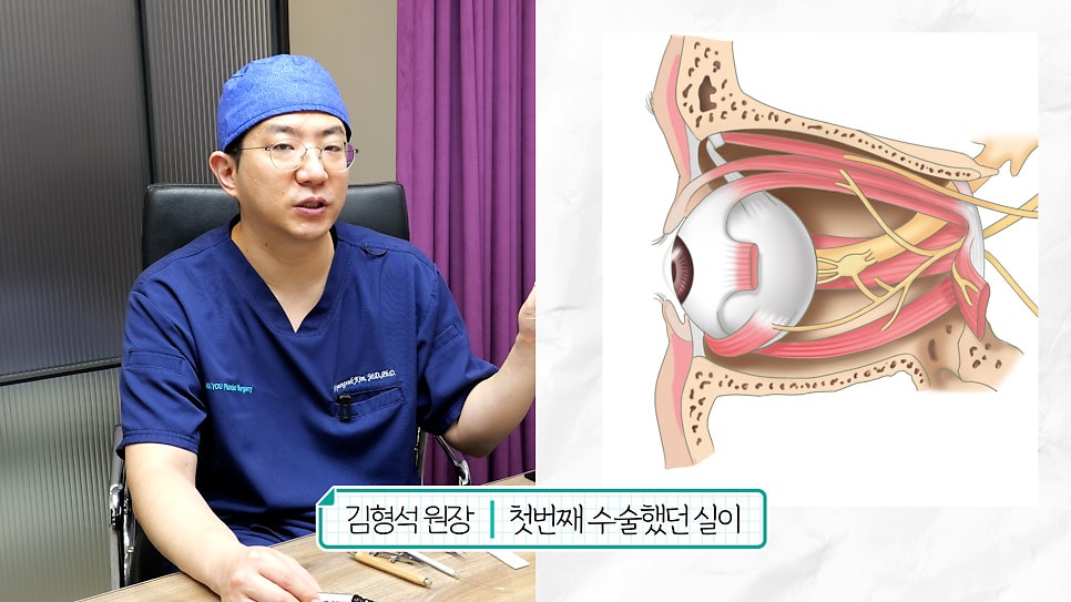 '쌍꺼풀 실 눈찌름'으로 안과? 쌍수실 제거+자연유착 라인 살리는 법 관련 이미지 6