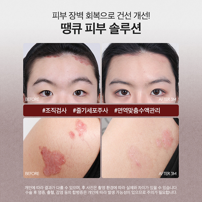 맥미걸 관련 이미지 8