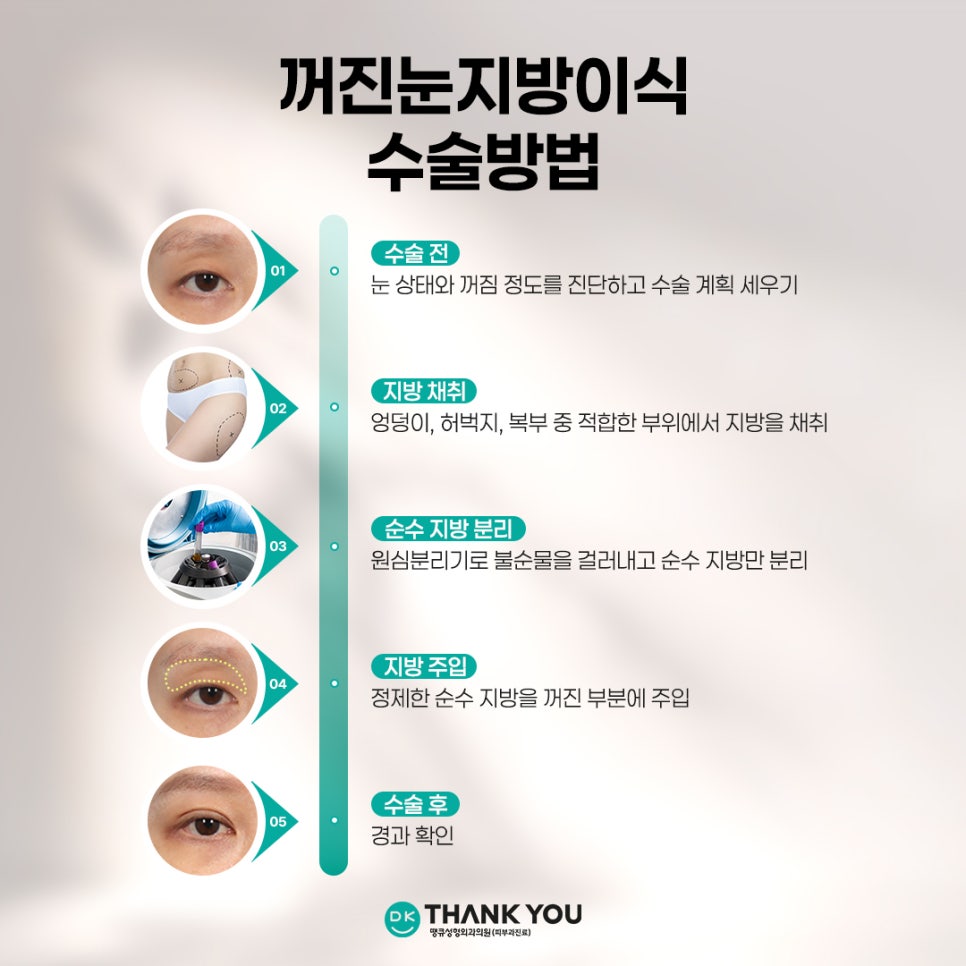 눈꺼풀꺼짐 개선하려면? 꺼진눈지방이식 전에 알아야 할 3가지 관련 이미지 11