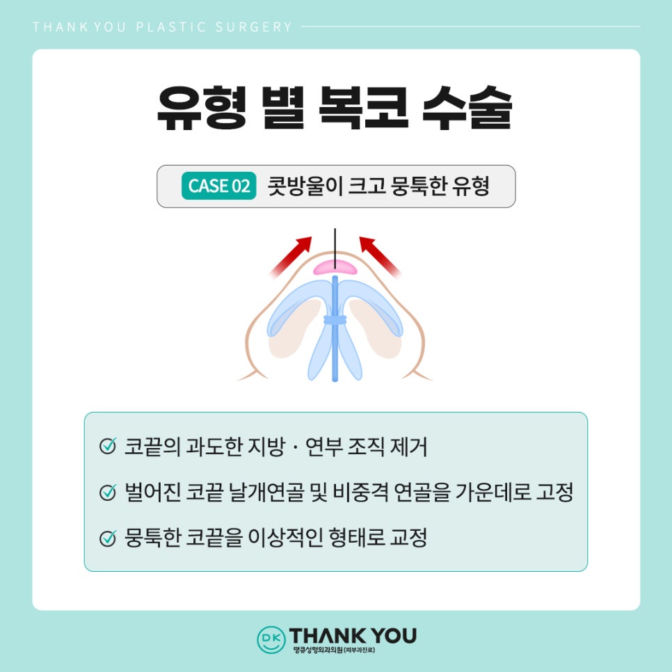 복코수술후기? 세련된 이미지 만드는 땡큐에서 확인! 관련 이미지 5
