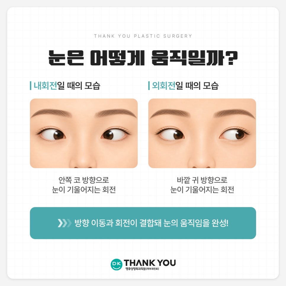 눈밑지방재배치 사시?! 눈밑지 사시는 왜 생길까 관련 이미지 3