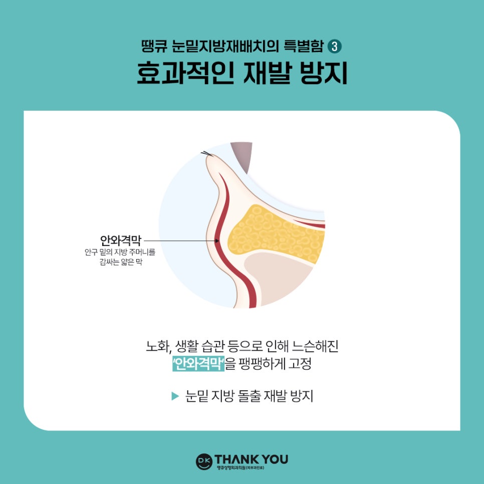 눈밑지방재배치잘하는병원 땡큐만의 특별한 노하우! 관련 이미지 5