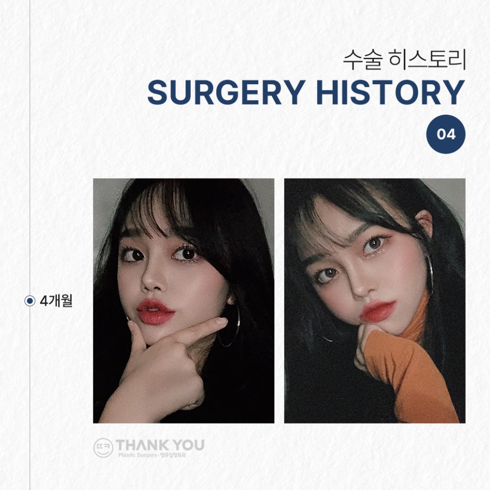 낮은코성형&얼굴지방흡입 후기 (땡큐성형외과 Real Story) 관련 이미지 7