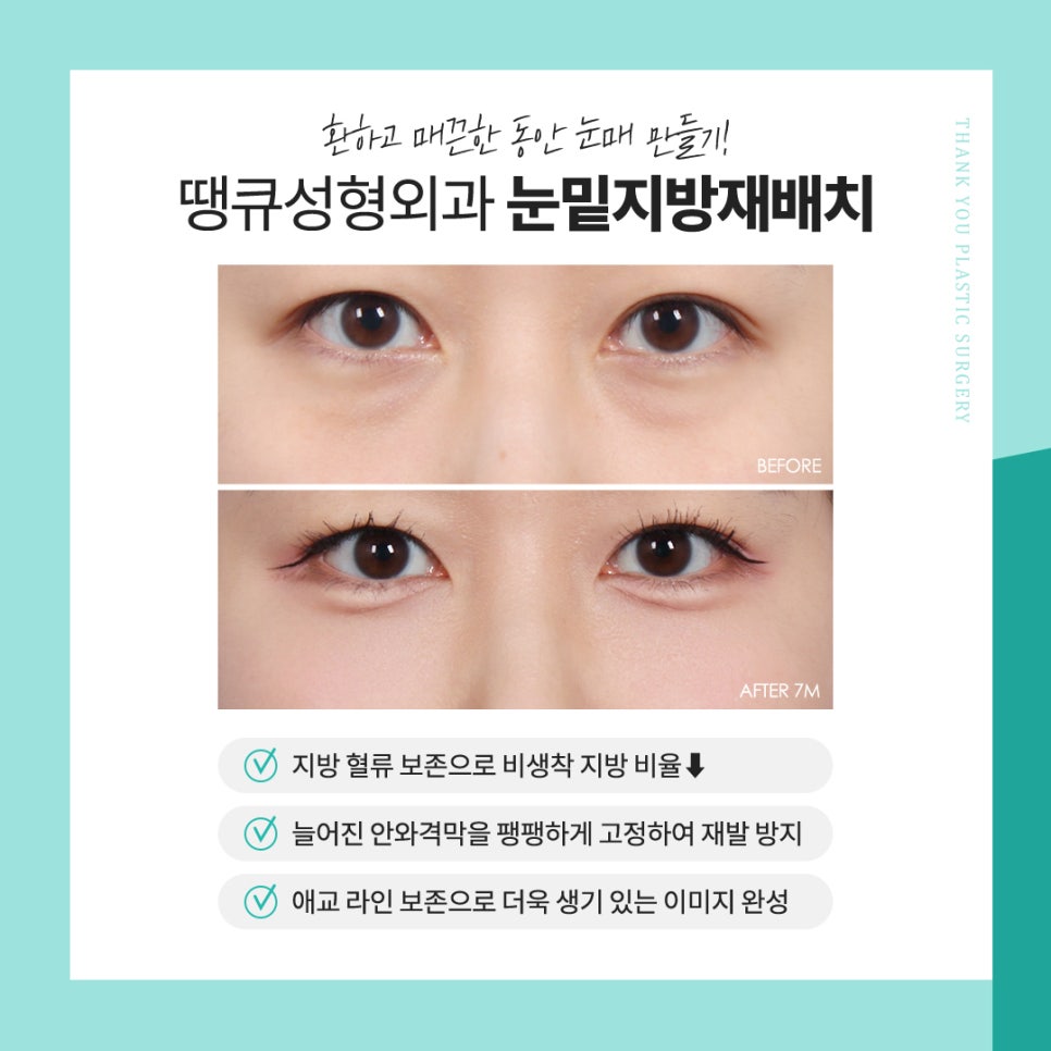 눈밑지 수술 후 얼굴처짐 생길까요? 관련 이미지 8