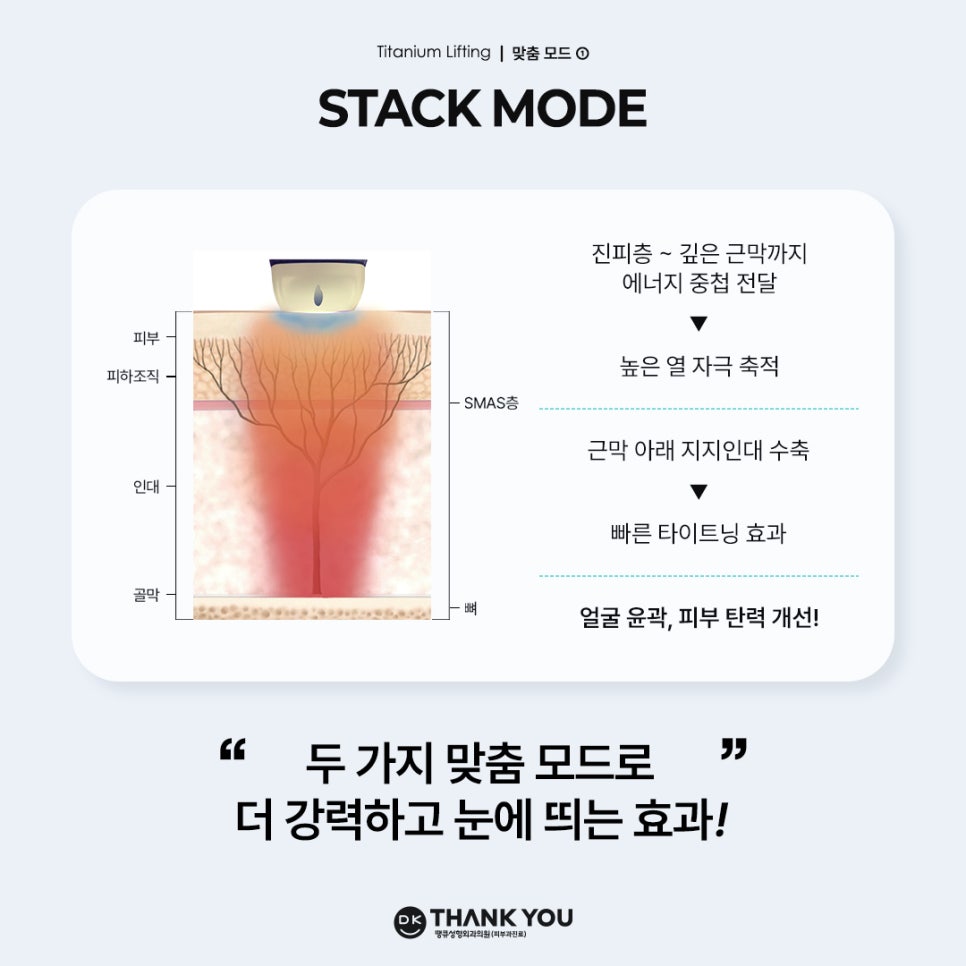 티타늄리프팅전후로 즉시 달라지는 탄력, 그 원리와 효과는? 관련 이미지 4
