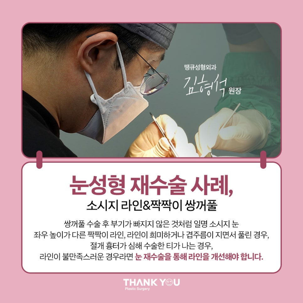 짝눈 교정, 쌍수 재수술 시기 알려드려요 관련 이미지 9