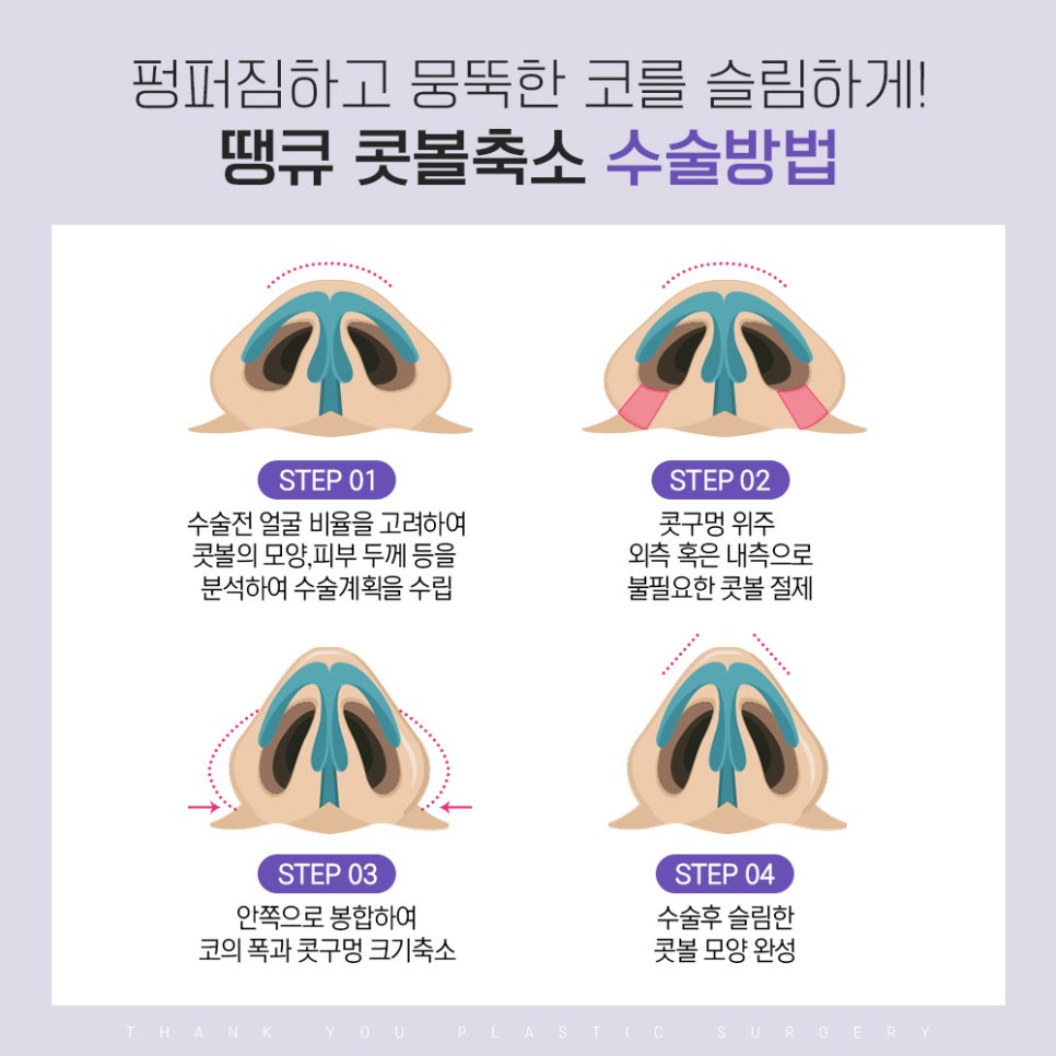 콧볼 축소 전후 체크, 땡큐 15분 콧볼축소 EVENT 관련 이미지 7