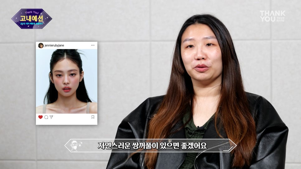 [비절개눈매교정+앞윗트임+눈밑지] 자고 일어났을 뿐인데 제니가?! 관련 이미지 13