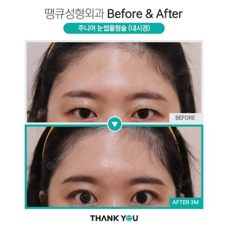 눈가 주름까지 개선하는 이마거상 관련 이미지 6