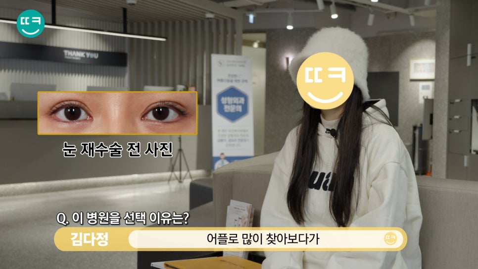 짝눈 쌍수 재수술, 짝짝이 라인과 비대칭쌍꺼풀 대칭 맞추기 관련 이미지 6