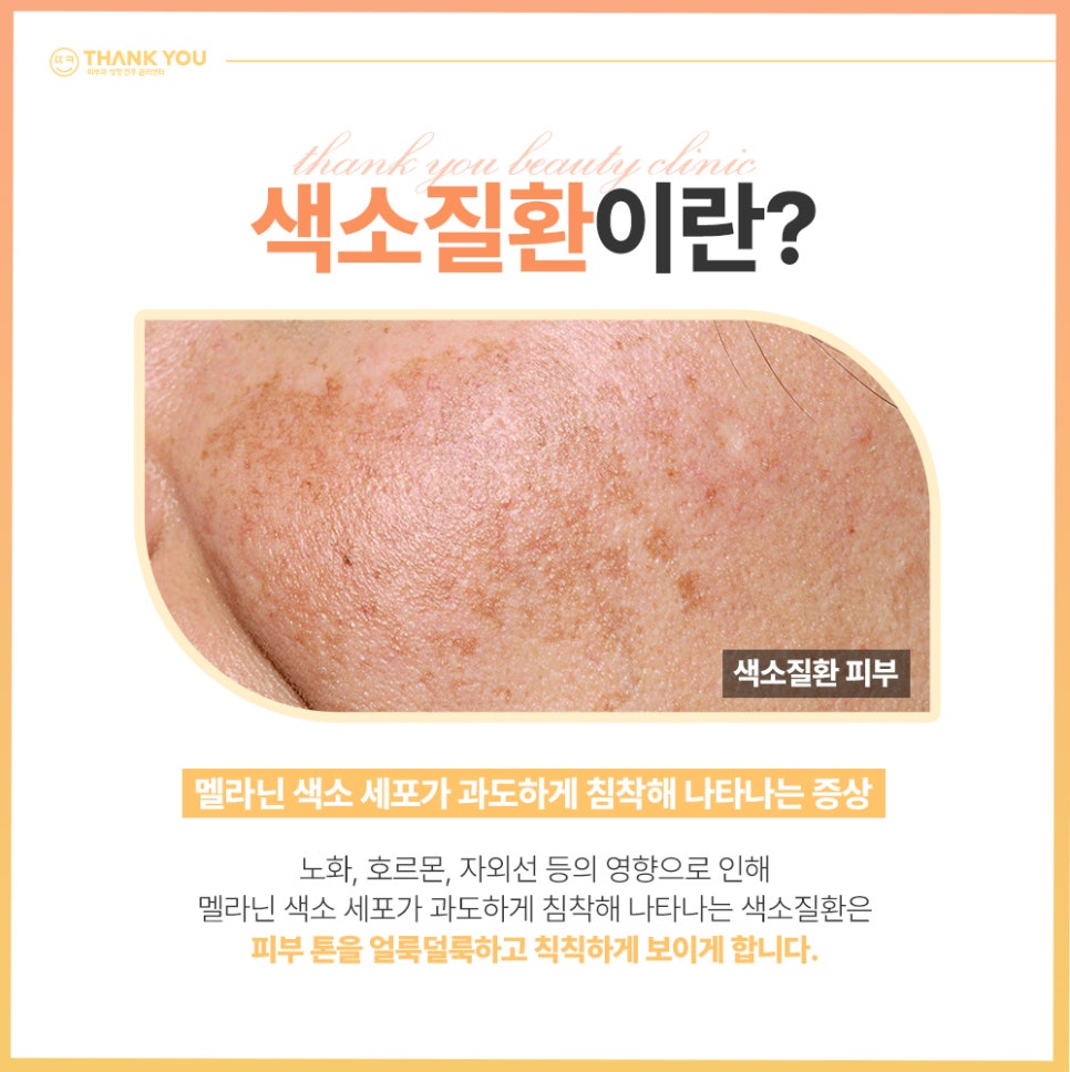 지디토닝 효과 :: 골드다이아 파티클로 미백, 필링 동시에 GD토닝 관련 이미지 2
