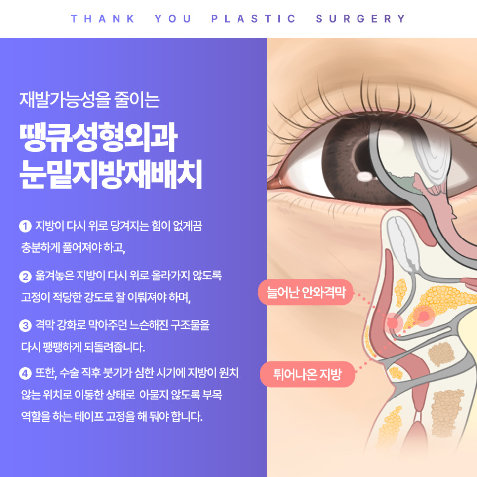 눈밑 불룩? 눈밑지방재배치 수술 후에도 재발할까? 관련 이미지 7