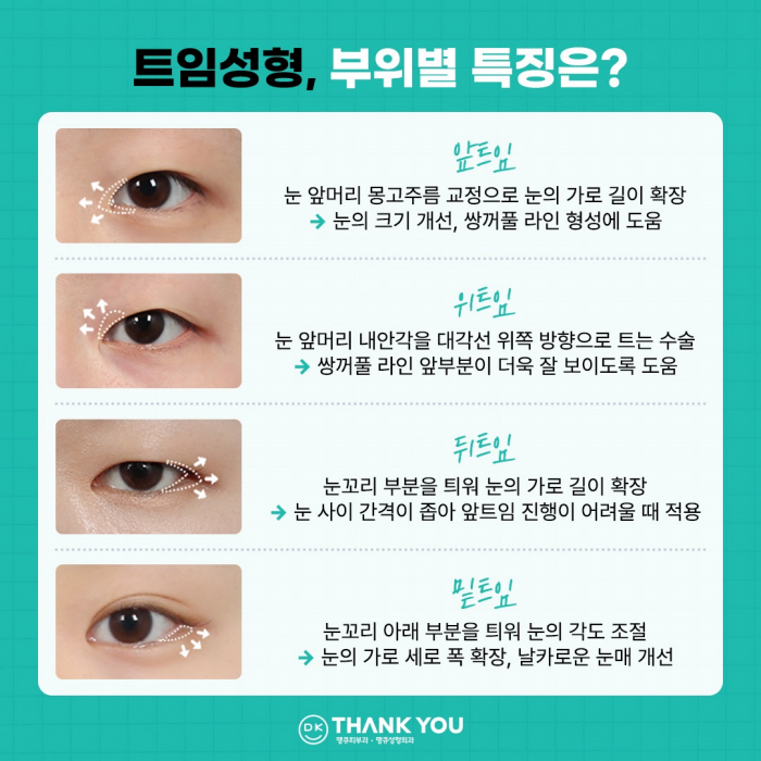 트임성형잘하는곳에서 알려주는 트임 위치별 특징 관련 이미지 3