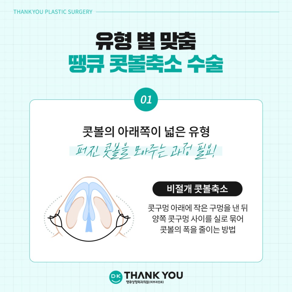 Rhinoplasty Before and After? See the Stylish Nose Created at Thank You Here! image 6
