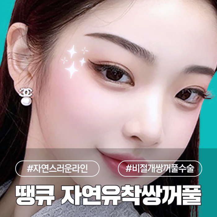 자연유착쌍커풀 수술로 타고난 듯 아름다운 눈 만들기🍀 관련 이미지 1