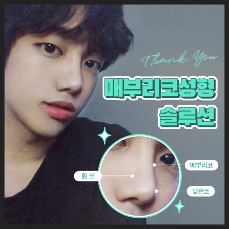 튀어나온 코? 남자 매부리코성형 솔루션 (ft. 메부리 전후) 관련 이미지 3