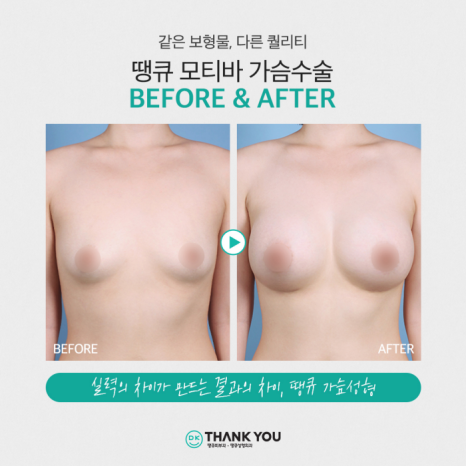 모티바가슴수술 가격 보다 먼저 고려해야 할 것은 관련 이미지 9