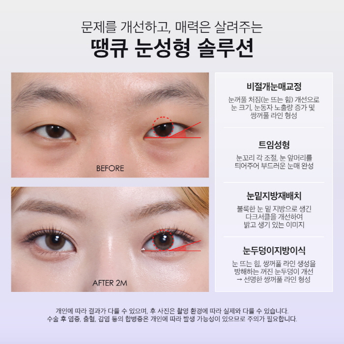 맥미걸 관련 이미지 3