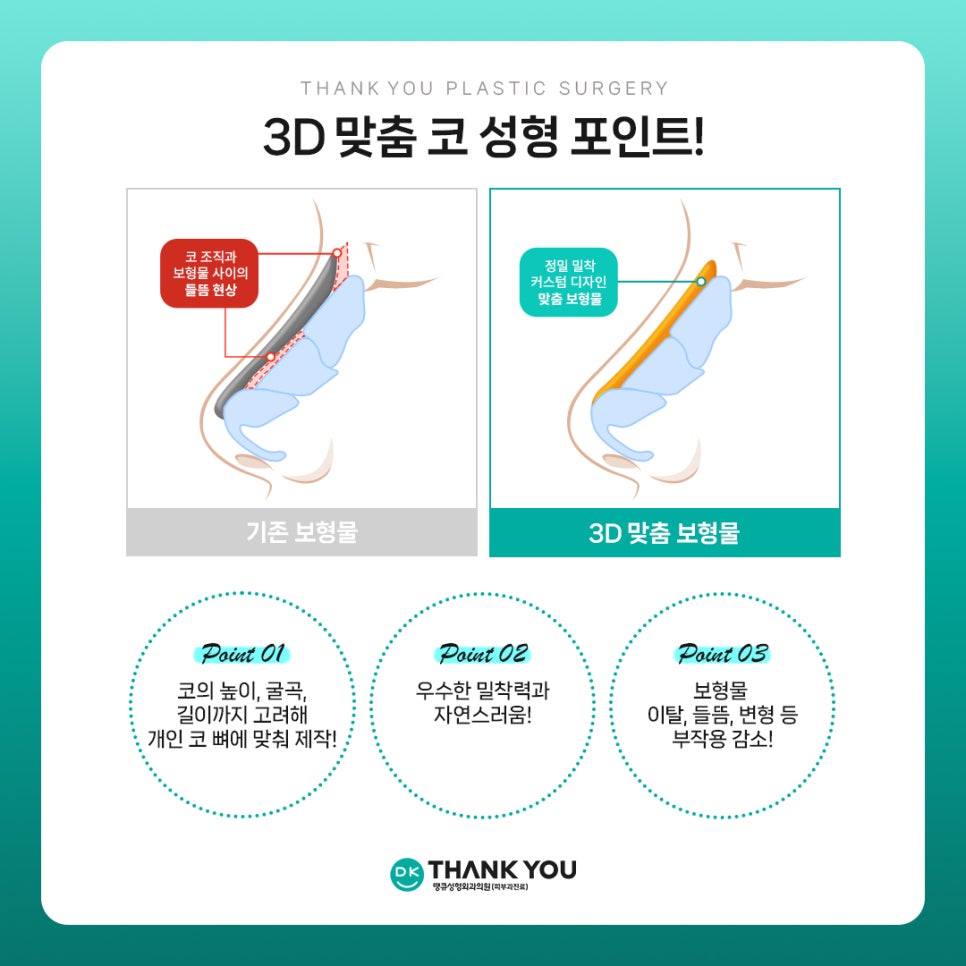 코성형전후, 만족스러운 차이를 얻고 싶다면?! 3D 맞춤 보형물 주목! 관련 이미지 2
