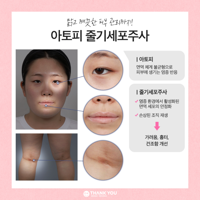 전신지흡 & 체형검사를 통한 성공적인 다이어트! 땡큐 with 맥미걸 관련 이미지 12