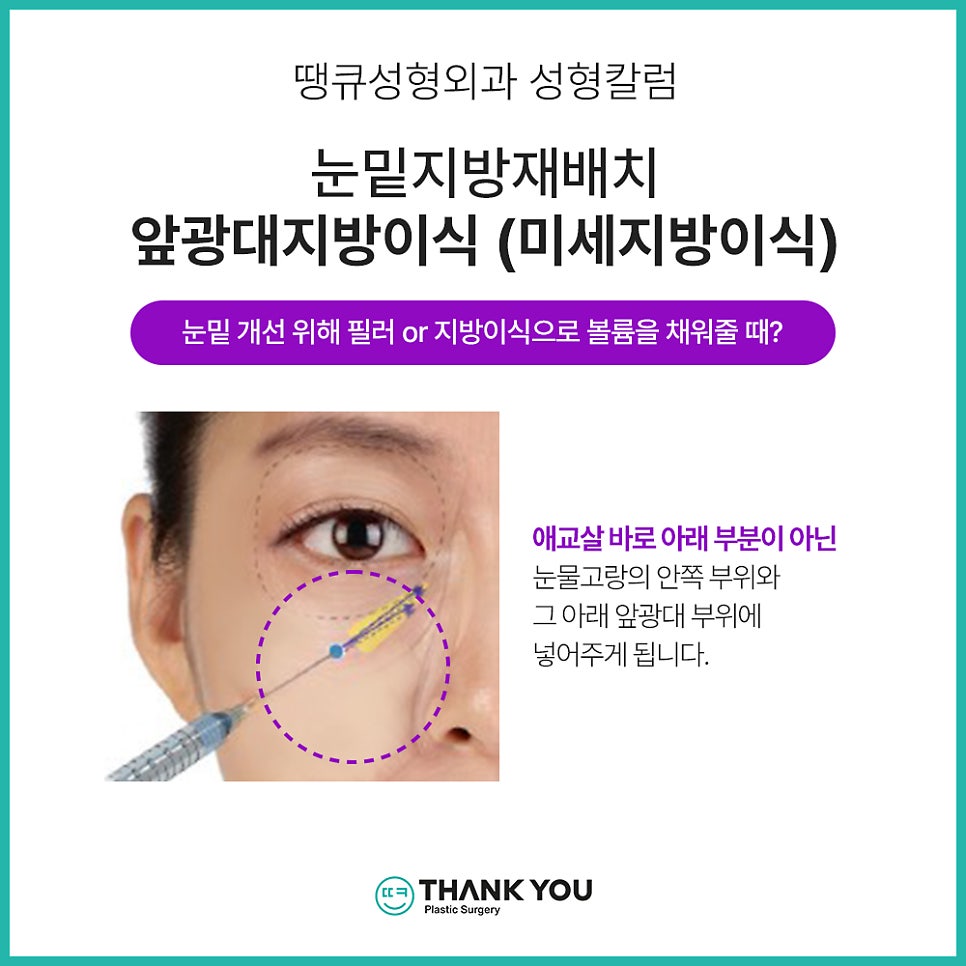 눈밑지방재배치 함께 필요한 미세 지방이식?(땡큐 나노펫) 관련 이미지 4