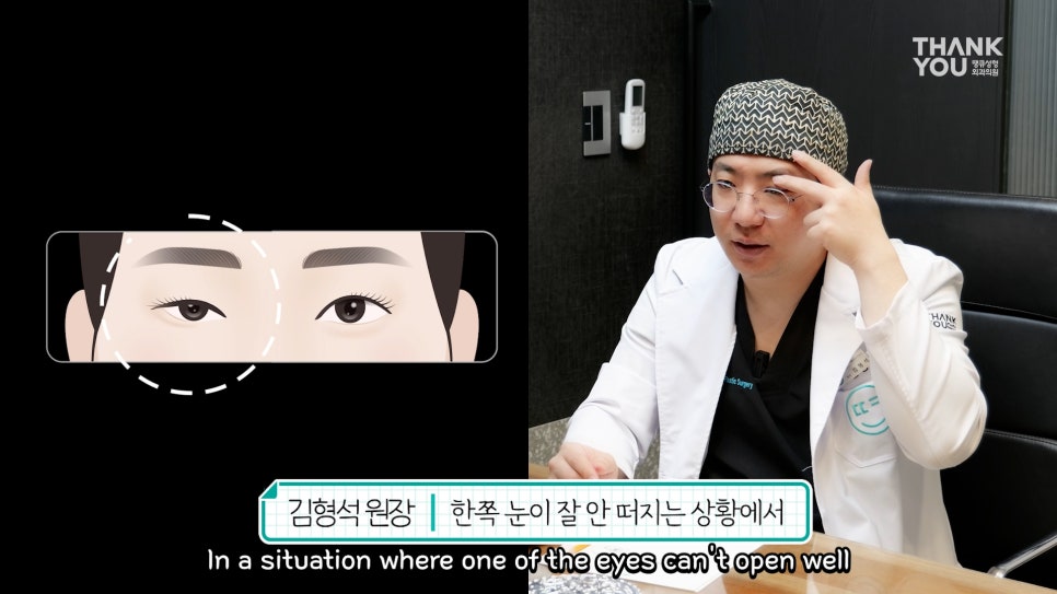 비대칭눈 교정(짝짝이 쌍꺼풀) 헤링의 법칙이란? 관련 이미지 6