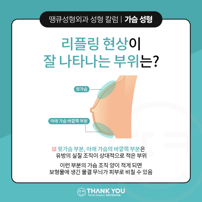 가슴수술 부작용 관련 이미지 4