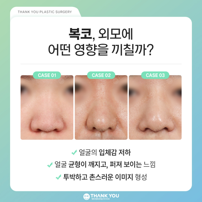 복코성형 전후, 명확한 차이를 만들고 싶다면?! 관련 이미지 2