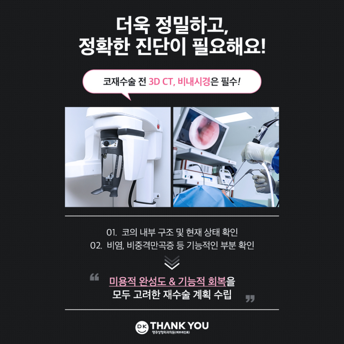 코재수술잘하는병원 땡큐 이벤트✨ 관련 이미지 9