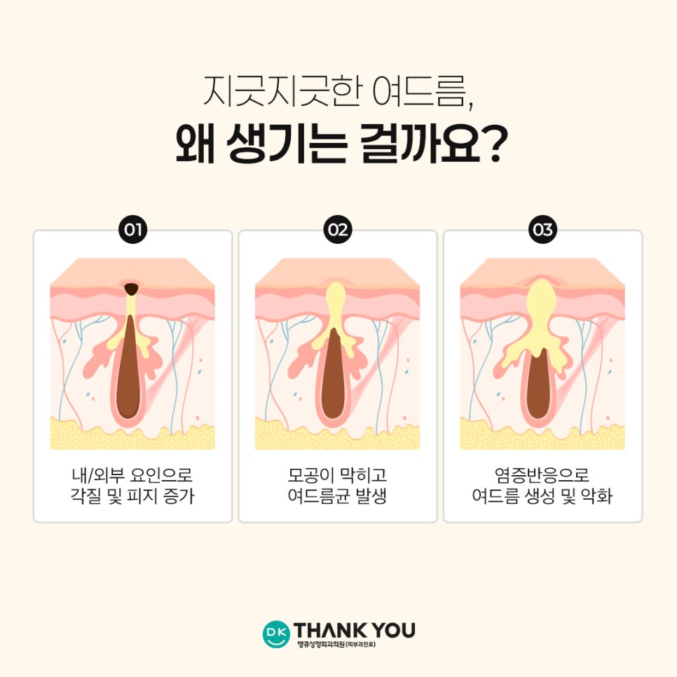 Curious About the Effects of Acne Scaling? Find Out at Thank You! image 3