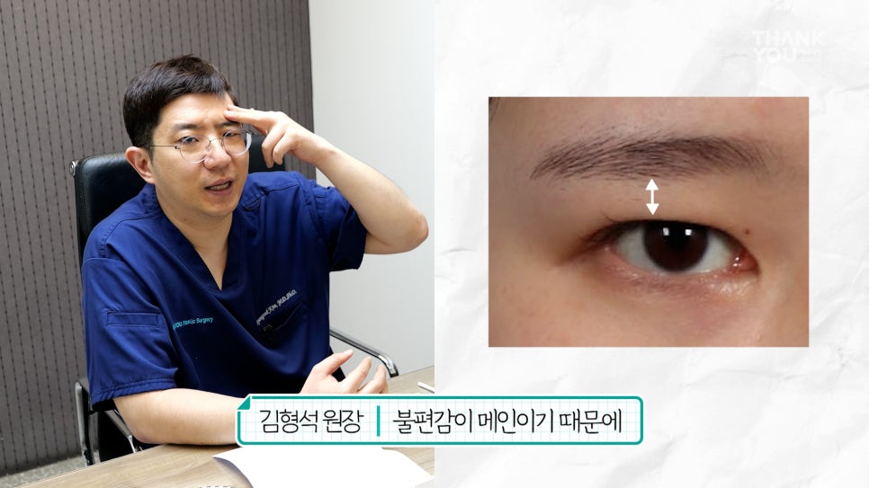 눈재수술 할 때 이마거상 추천하는 이유는? (눈썹올림술 전후) 관련 이미지 14