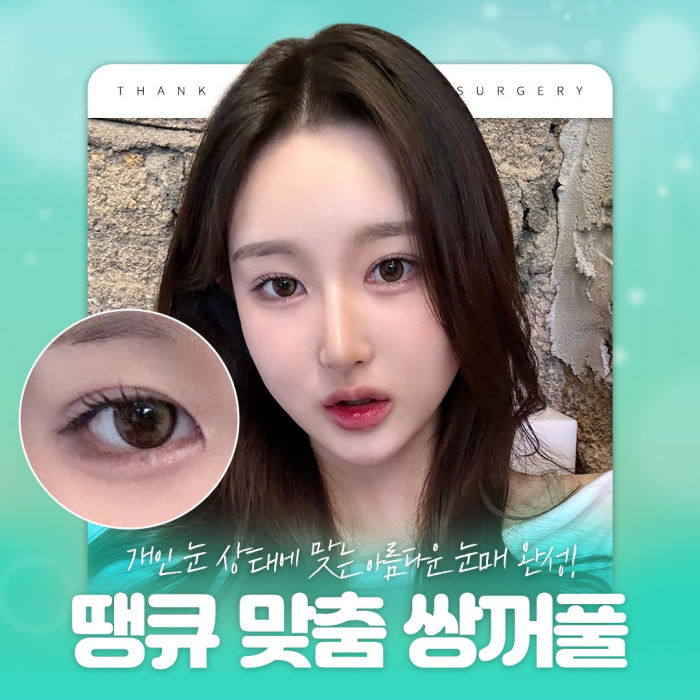 쌍꺼풀수술병원에서 알려주는 눈성형 성공 포인트! 관련 이미지 1