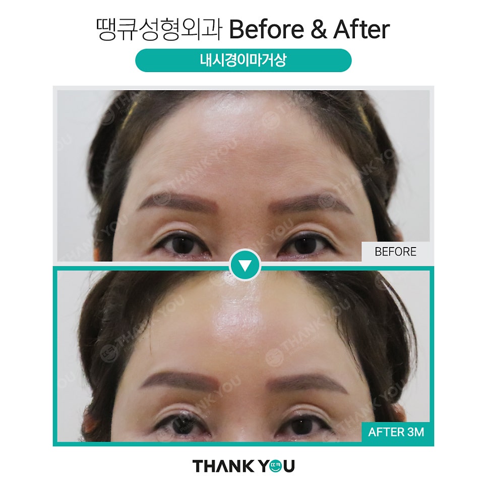 눈가 주름까지 개선하는 이마거상 관련 이미지 9