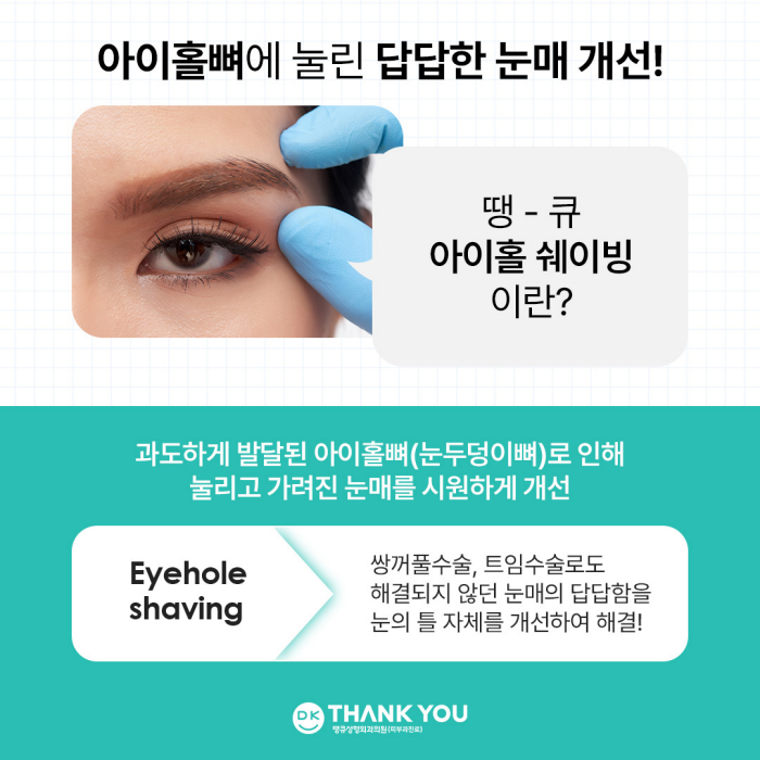 눈매개선, 눈성형으로 해결되지 않는다면?! 눈의 틀을 개선하는 아이홀쉐이빙 관련 이미지 3