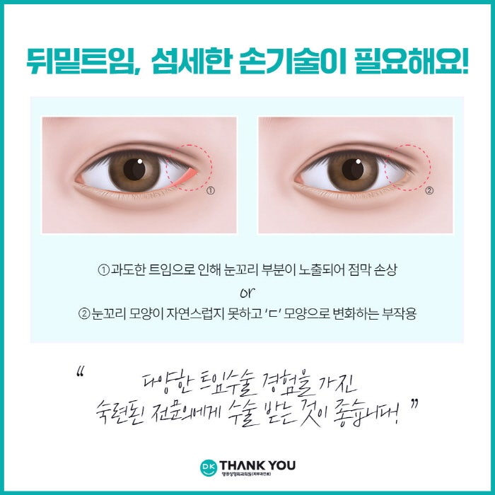 뒤밑트임 수술로 눈의 크기는 물론 이미지 개선까지! 관련 이미지 4