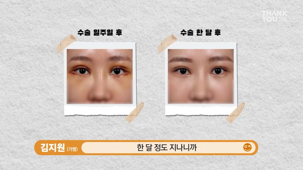 엄빠 몰래 이마거상 성공! (뒤밑트임 후기) 관련 이미지 12