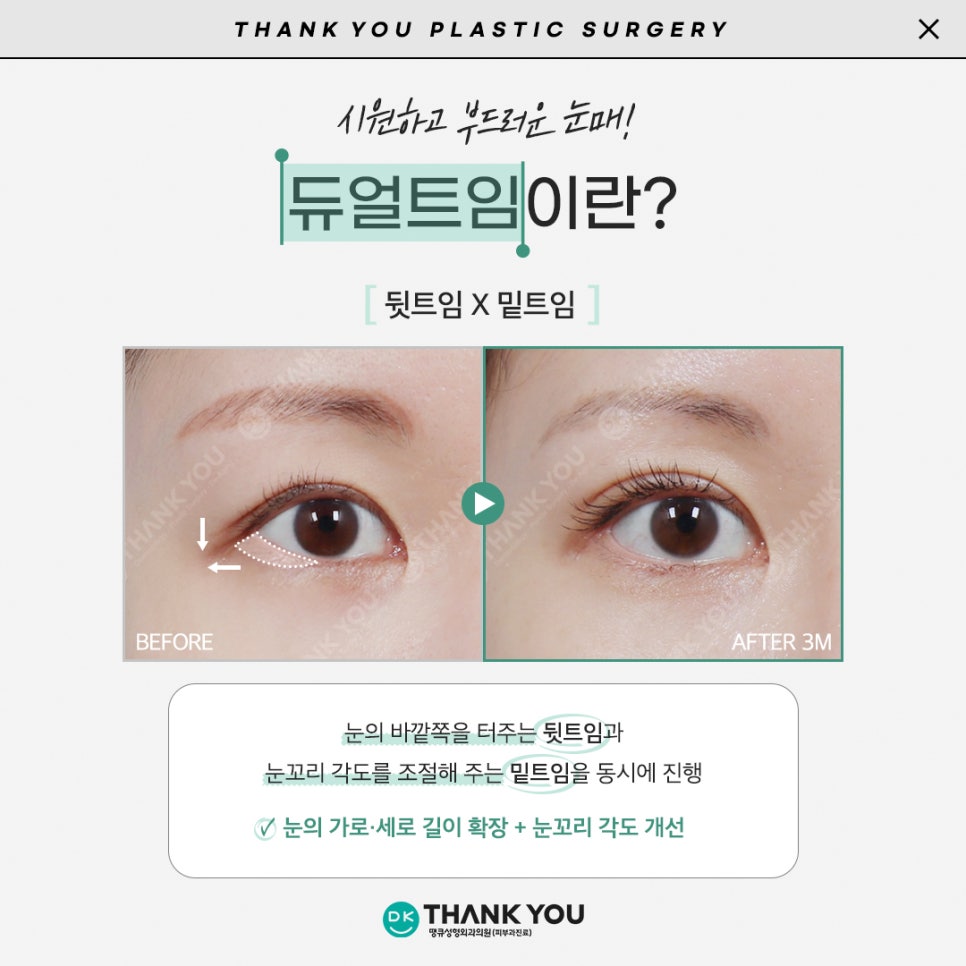 듀얼트임효과로 답답한 꼬막눈을 시원하게! 관련 이미지 5