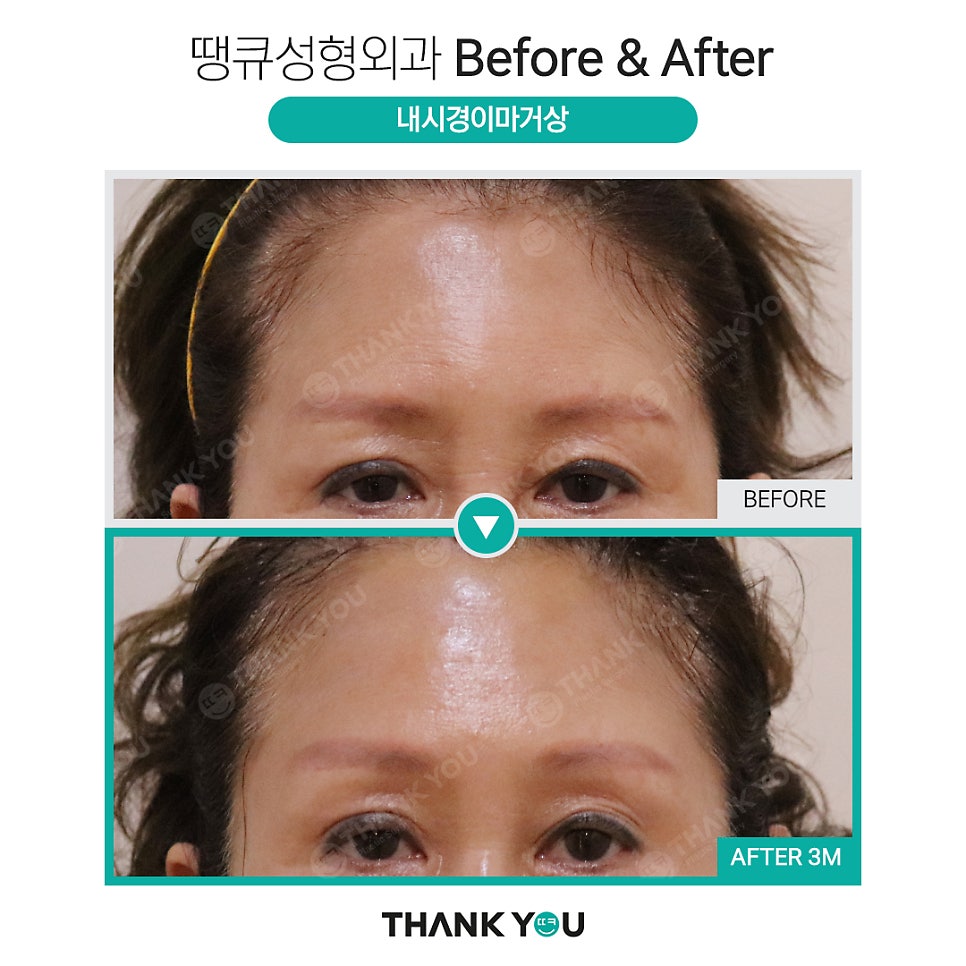 눈가 주름까지 개선하는 이마거상 관련 이미지 7