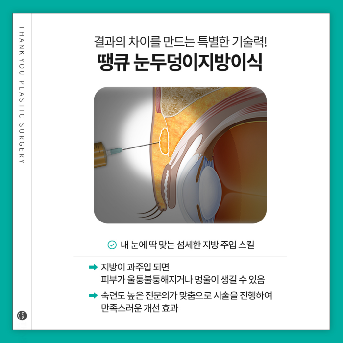 눈두덩이지방이식으로 피곤한 이미지 탈출! 생기있는 눈매 완성! 관련 이미지 7