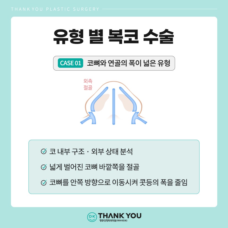 복코수술후기? 세련된 이미지 만드는 땡큐에서 확인! 관련 이미지 4