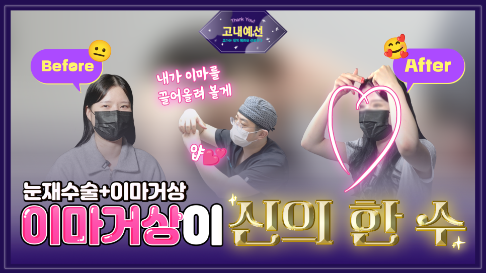 쌍꺼풀 풀림 쌍수 라인 풀림 증상? 이마거상수술로 개선! 관련 이미지 1