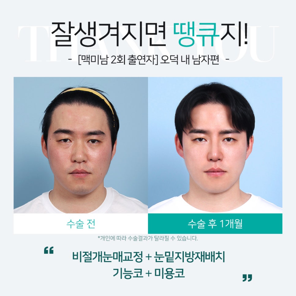 MAKE미남(맥미남) 오덕차장님의 노안 개선&남자 비염코성형 전후 관련 이미지 3