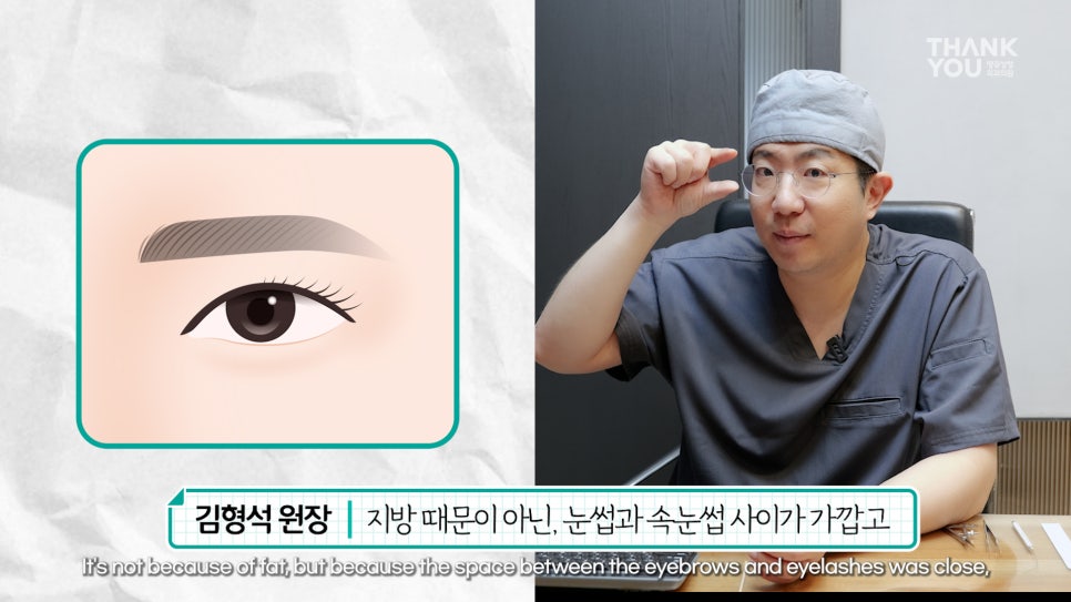 쌍수에 눈썹올림술을 추천하는 이유?! 관련 이미지 13