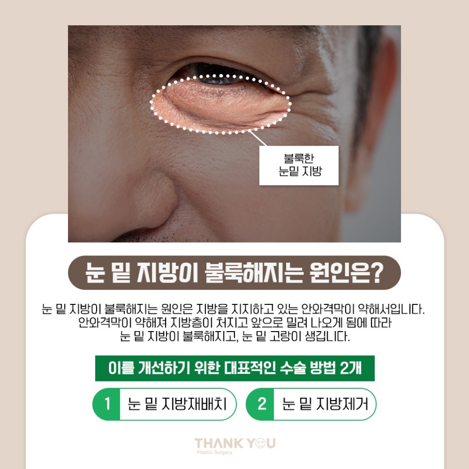 프리미엄 눈밑지방재배치(원데이)란? 땡큐 이호준 원장님 관련 이미지 3