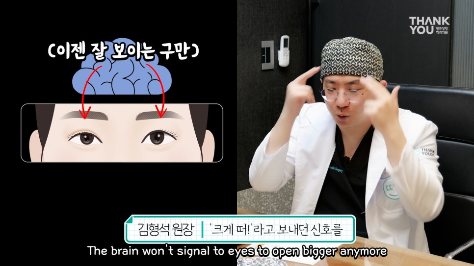 비대칭눈 교정(짝짝이 쌍꺼풀) 헤링의 법칙이란? 관련 이미지 12