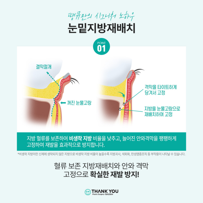 눈밑지방재배치잘하는곳은 이렇게 합니다✨✨ 관련 이미지 4