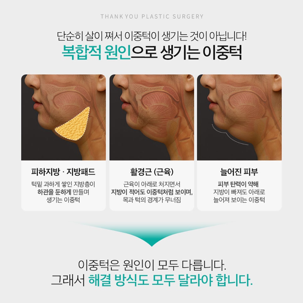 Not Enough Improvement from Chin Liposuction Alone? How About Thank You Double Chin Removal Surgery?! image 3