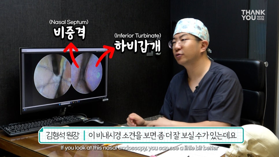 2분만에 막힌 코 뻥 뚫어주는 코블레이션 [ft.비염코성형 전후] 관련 이미지 25