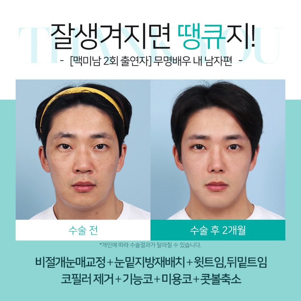 맥미남 성형외과, 오덕&무명배우 내남자 땡큐 솔루션 제공 관련 이미지 4