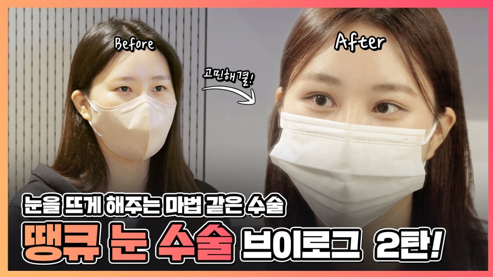 엄빠 몰래 이마거상 성공! (뒤밑트임 후기) 관련 이미지 3
